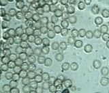 Dacryopinax elegans image