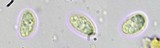 Lecidella carpathica image