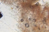 Microstoma floccosum image
