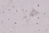 Fomitopsis cajanderi image
