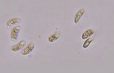 Dacryopinax elegans image