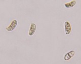 Dacryopinax elegans image