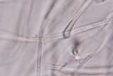 Dacryopinax elegans image