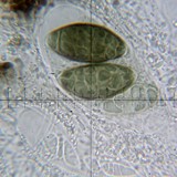 Diplotomma penichrum image