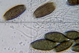 Diplotomma penichrum image