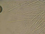 Vibrissea truncorum image
