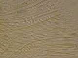 Vibrissea truncorum image