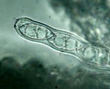 Cookeina tricholoma image