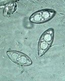 Cookeina tricholoma image