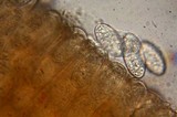Microstoma floccosum image
