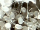 Redeckera fulvum image