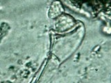 Redeckera fulvum image
