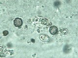 Redeckera fulvum image