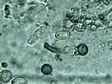 Redeckera fulvum image