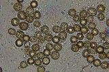 Ustilago maydis image