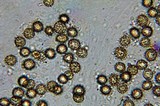 Ustilago maydis image