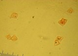 Tetrapyrgos nigripes image