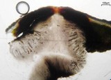 Pyrenula pseudobufonia image