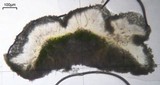 Lichenodiplis lecanorae image