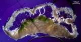 Lichenodiplis lecanorae image