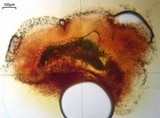 Lichenodiplis lecanorae image