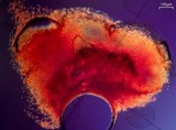 Lichenodiplis lecanorae image