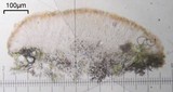 Lecanora cinereofusca image