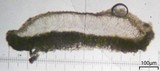 Lecanora strobilina image