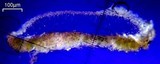 Lecanora strobilina image