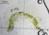 Lecanora strobilina image