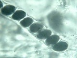 Poronia pileiformis image