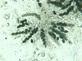 Poronia pileiformis image