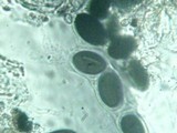 Poronia pileiformis image