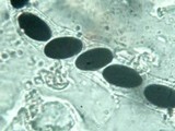 Poronia pileiformis image