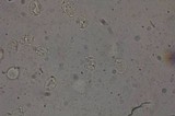 Cystodermella granulosa image