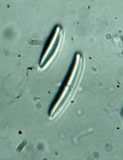 Ramalina stenospora image