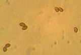 Galerina mammillata image