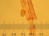 Cantharellus septentrionalis image