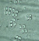 Limacella subillinita image