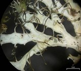 Heterodermia appalachensis image