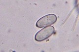 Cyathus stercoreus image
