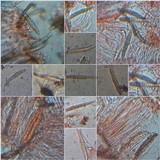 Thelotrema lepadinum image