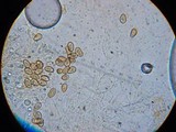Inocybe leucoblema image