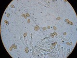 Inocybe leucoblema image