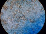 Inocybe leucoblema image