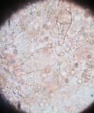 Pluteus longistriatus image