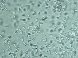 Laternea triscapa image