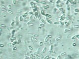 Laternea triscapa image