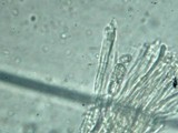 Encoelia heteromera image