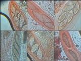 Pertusaria leioplaca image
